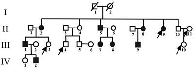 Evaluation of iron deposition in the motor CSTC loop of a Chinese family with paroxysmal kinesigenic dyskinesia using quantitative susceptibility mapping